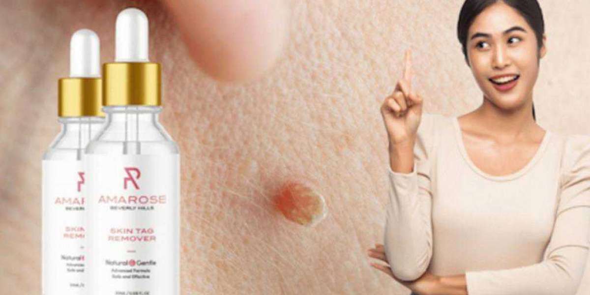 Amarose skin tag remover Where To Buy
