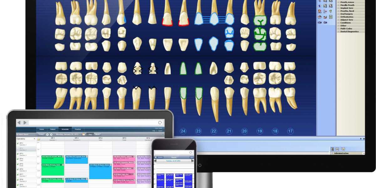 Dental Practice Management Software Market to Surge With Enhanced Funding In The Healthcare Sector