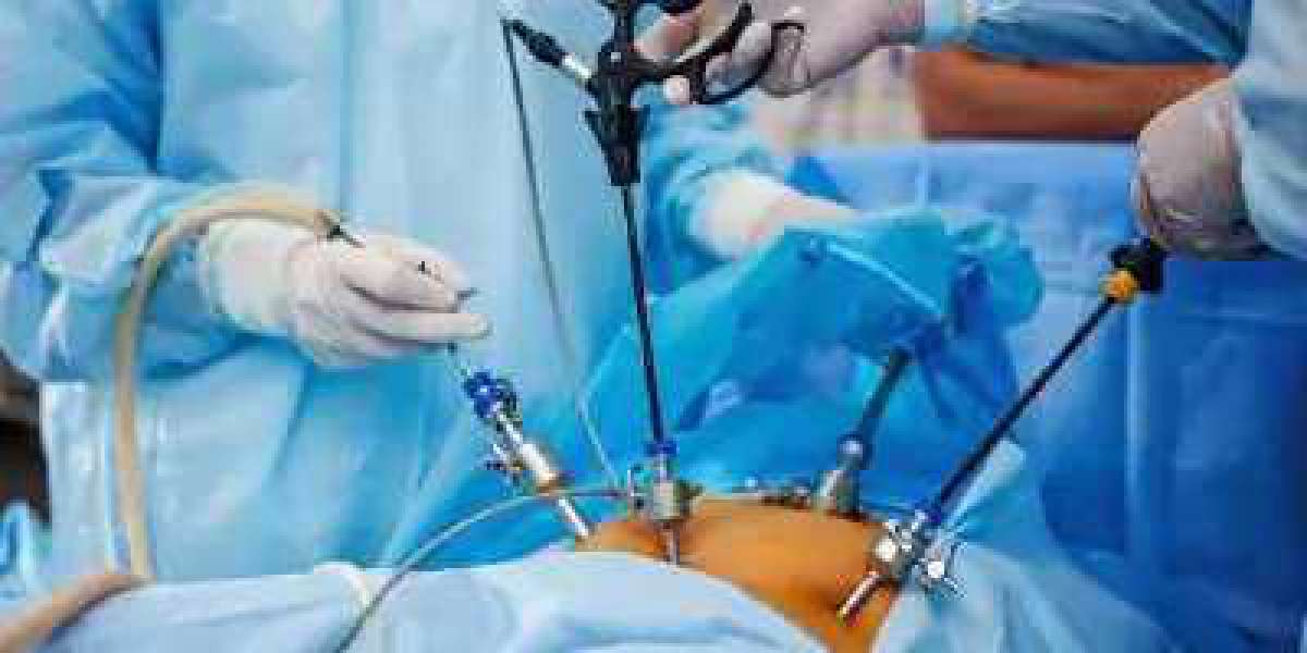 Experience The Best Laparoscopic Surgery in Chengalpattu - Sai Fertility Centre and Hospital
