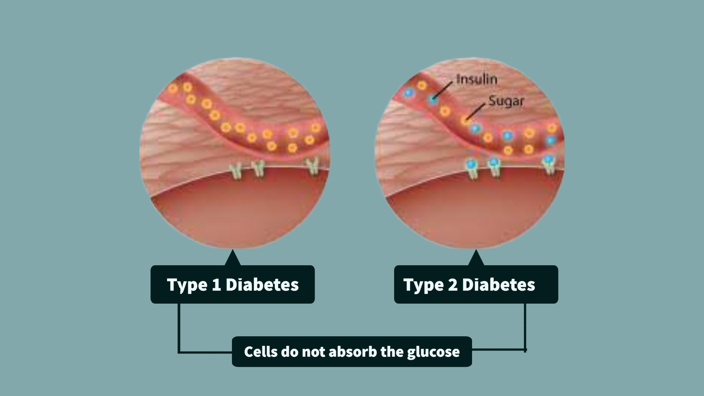 Early Diabetes Signs and Symptoms, Causes, Remedies - VIMS