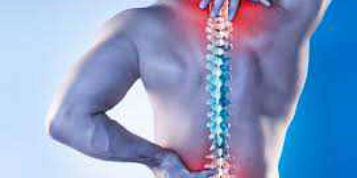 Comprehensive Guide to Correcting Posture and Preventing Back Pain