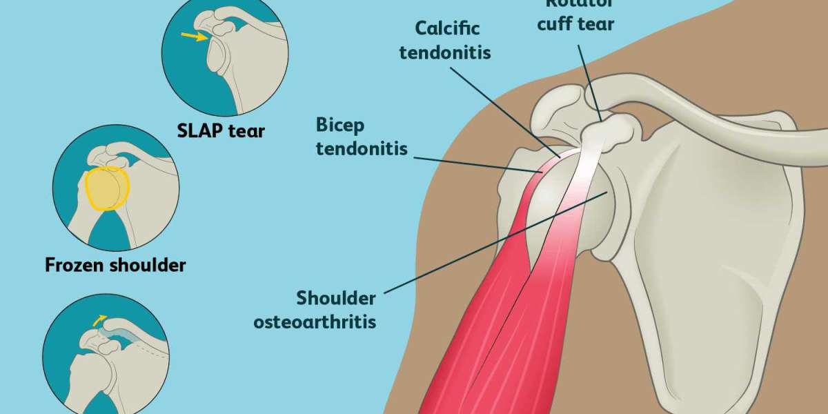 Breaking Down Joint Pain: Types, Symptoms, and Treatment Options