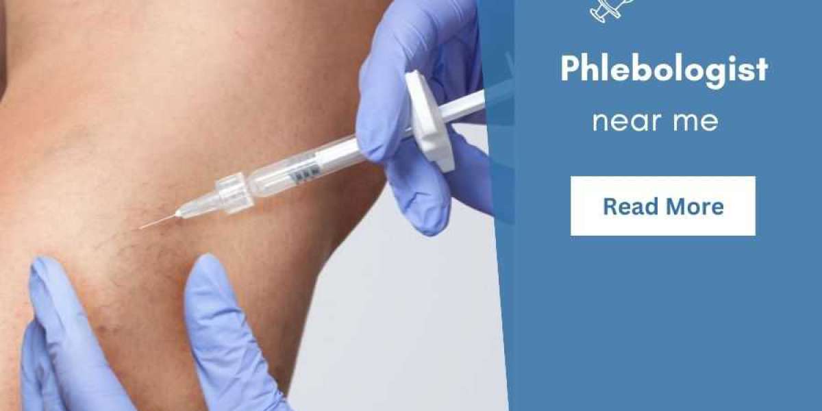 How to Find the Best Vein Specialist or Phlebologist?