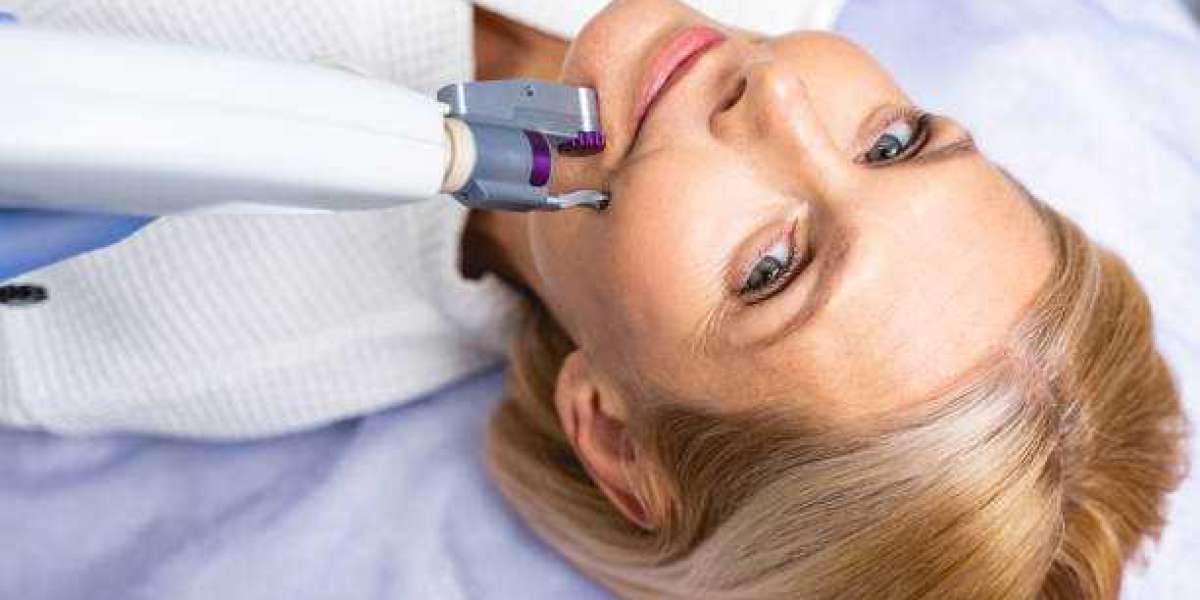 Laser Hair Removal: Unveiling the Pinnacle of Permanent Hair Reduction