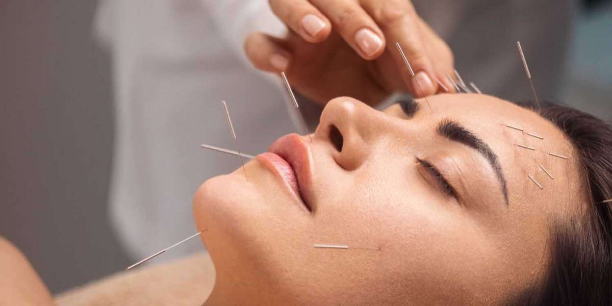 Unlocking the Secrets: How Acupuncture Helps with Chronic Pain