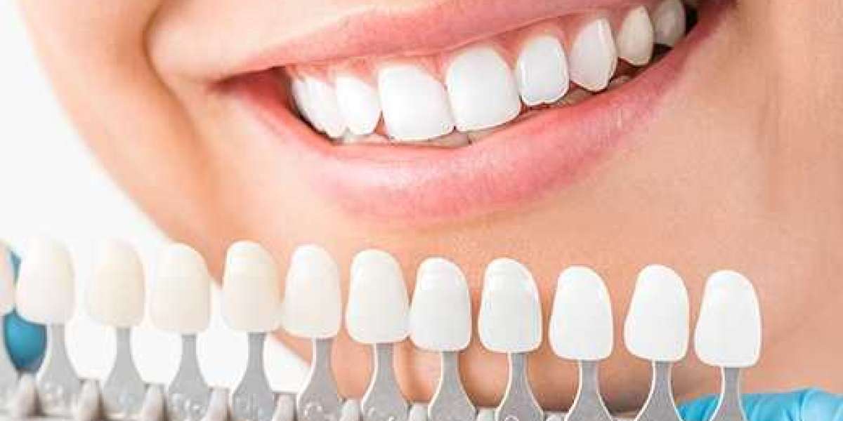 San Dimas Dental Care: Crafting Confident Smiles with Cosmetic Dentistry in Bakersfield