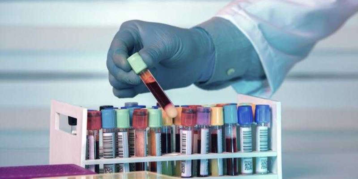 Global Biobanking Market Share, Trends, Report and Forecast 2024-2032