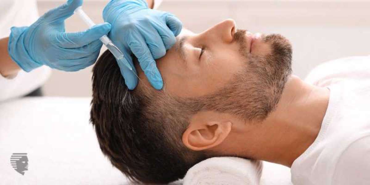 Hair Transplant in Kottayam