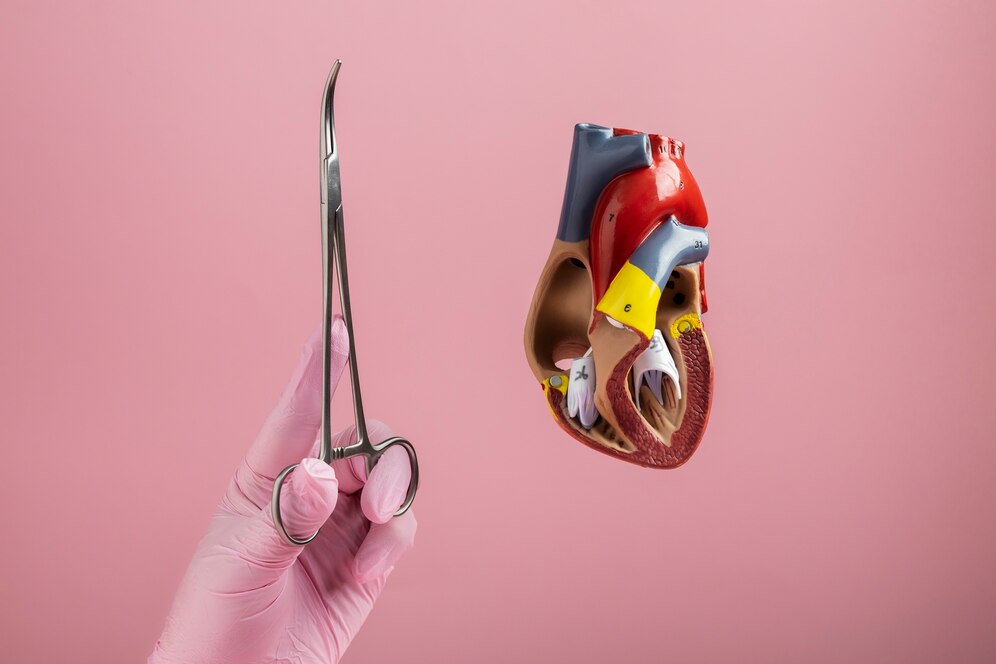 Understanding the Different Types of Bypass Surgery - WriteUpCafe.com