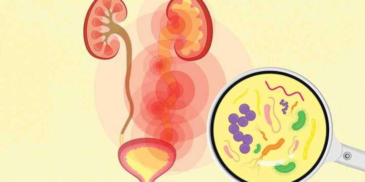 Uncomplicated Urinary Tract Infection Market Size, Share, and Analysis Year To 2021 – 2030