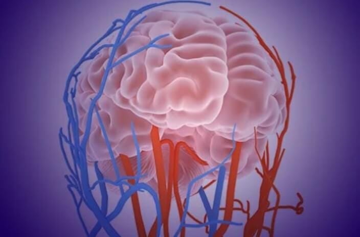 The Latest Advancements in Aneurysm Brain Treatment in Gujarat | by Drkalpeshneurosurgeon | Jun, 2024 | Medium