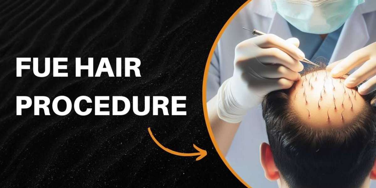 The Positive Outcomes of the FUE Hair Procedure