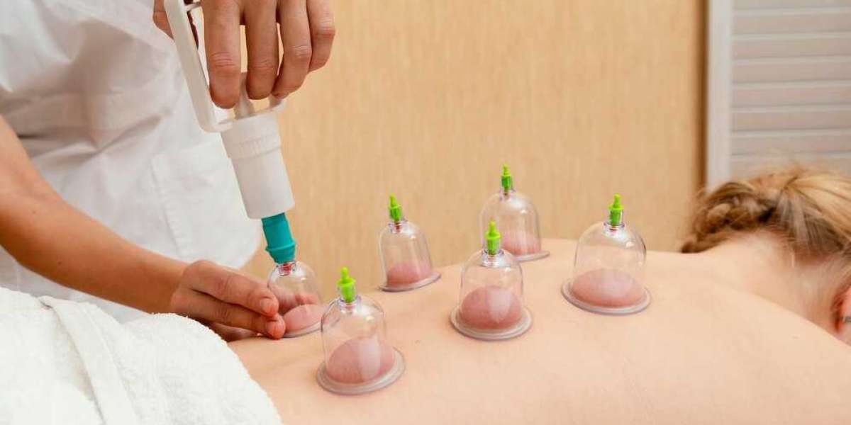 How Cupping Therapy Enhances Your Athletic Performance in Las Vegas