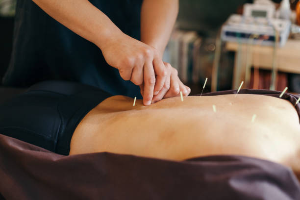 Acupuncture for Weight Loss: How It Works and Why It’s Effective - The Guest Blogs