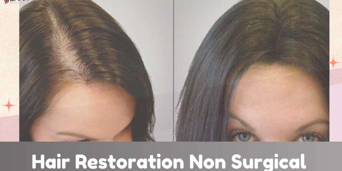 How to Choose the Best Non-Surgical Hair Restoration Method