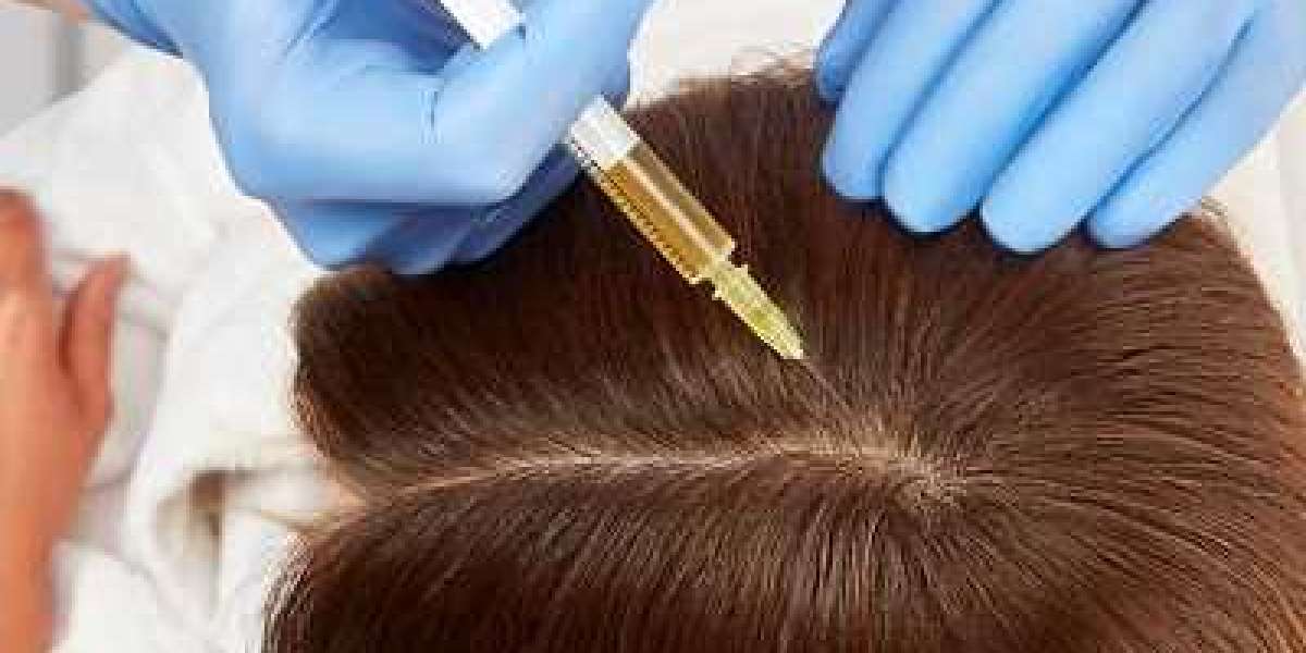 Can I Shampoo My Hair After PRP?