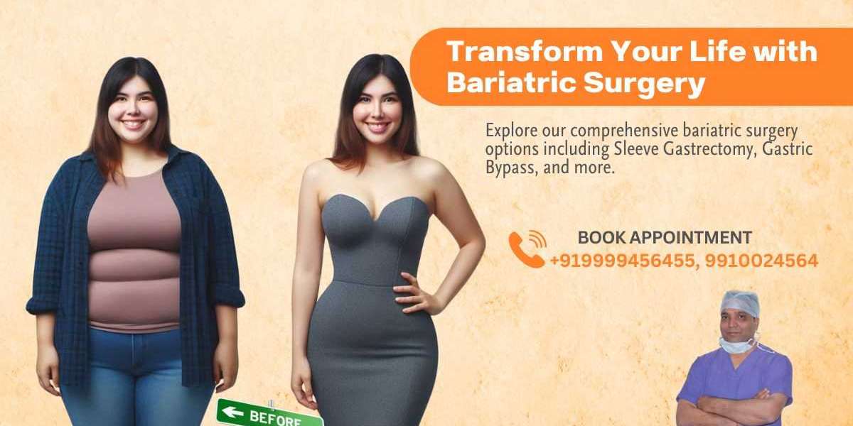 Understanding Bariatric Surgery: A Comprehensive Overview