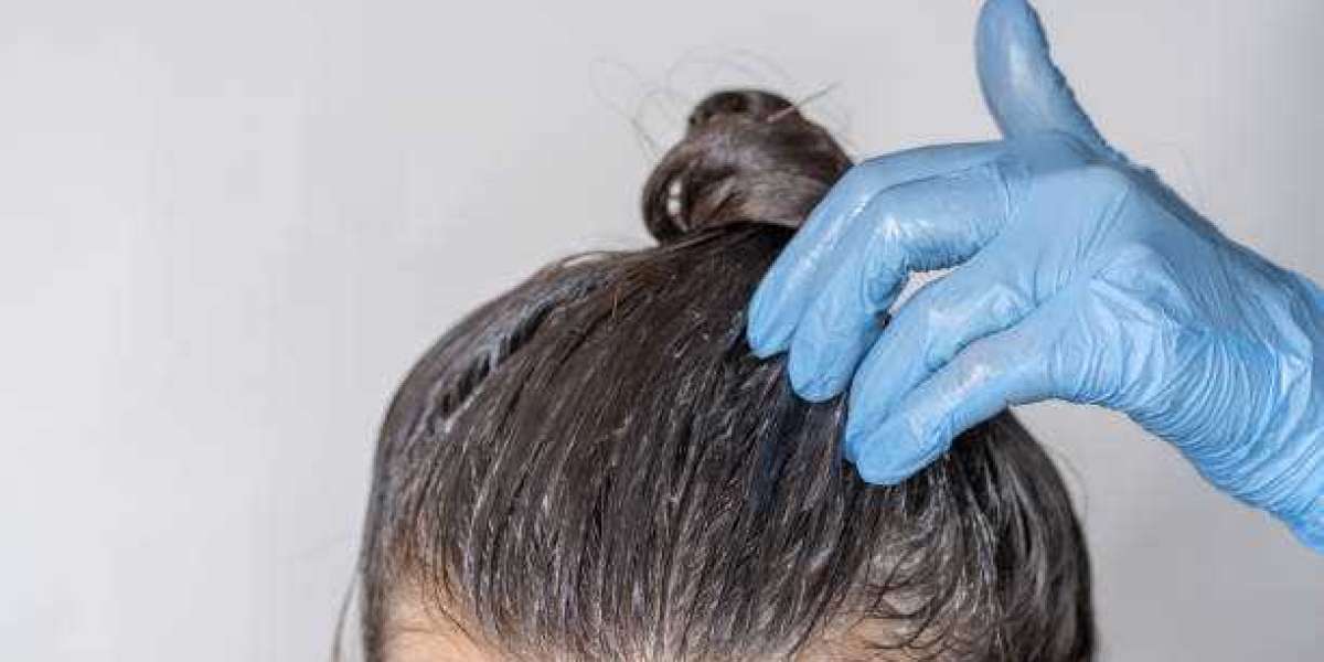 Hair PRP Treatment in Karachi: A Revolutionary Solution for Hair Restoration