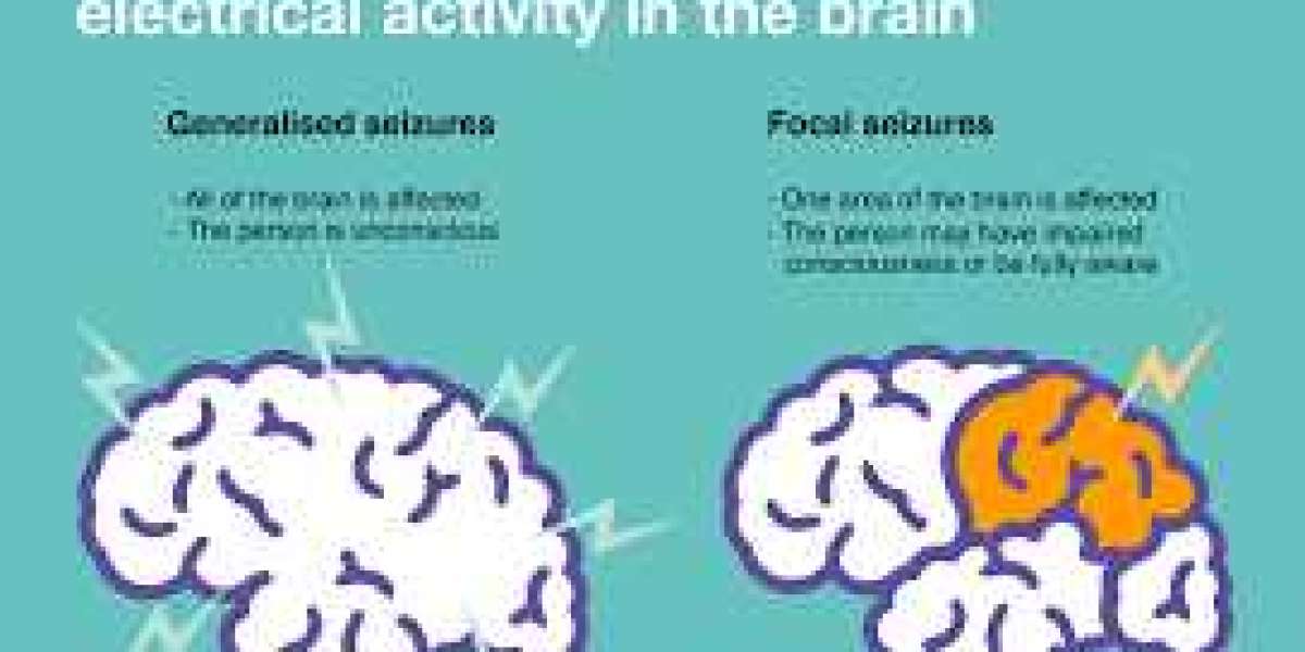 Gabapentin's Interaction with Nerve Cells: A Comprehensive Overview