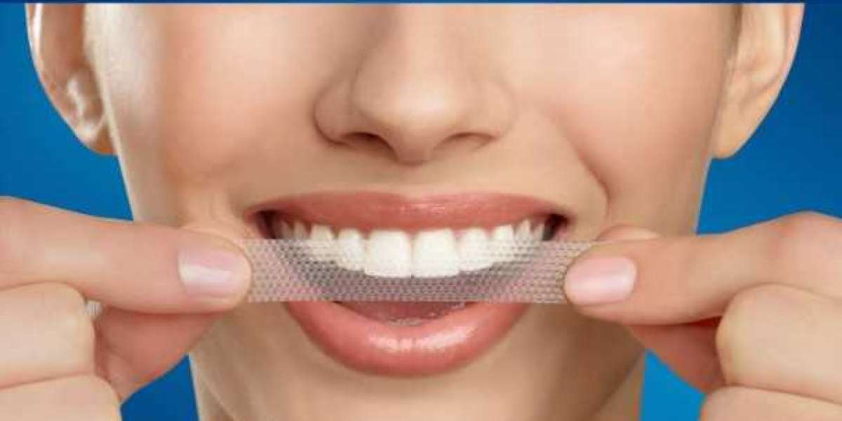 Crest Whitening Strips: The Trusted Choice for Safe and Effective Teeth Whitening in the UK