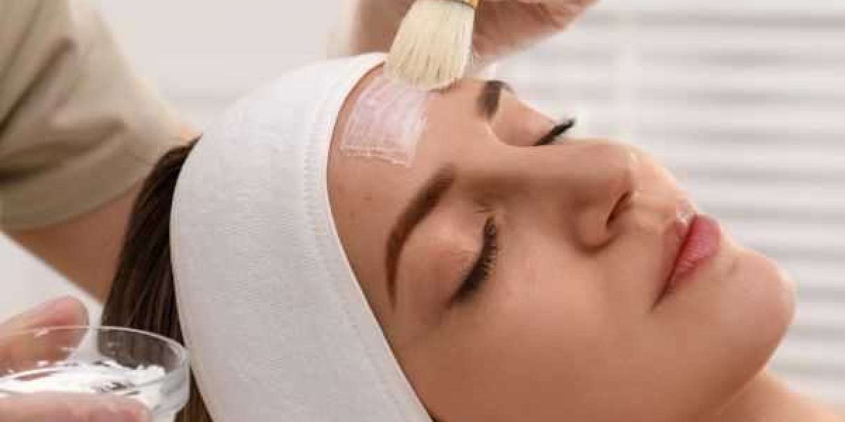 Understanding the Costs of Chemical Peels in Islamabad