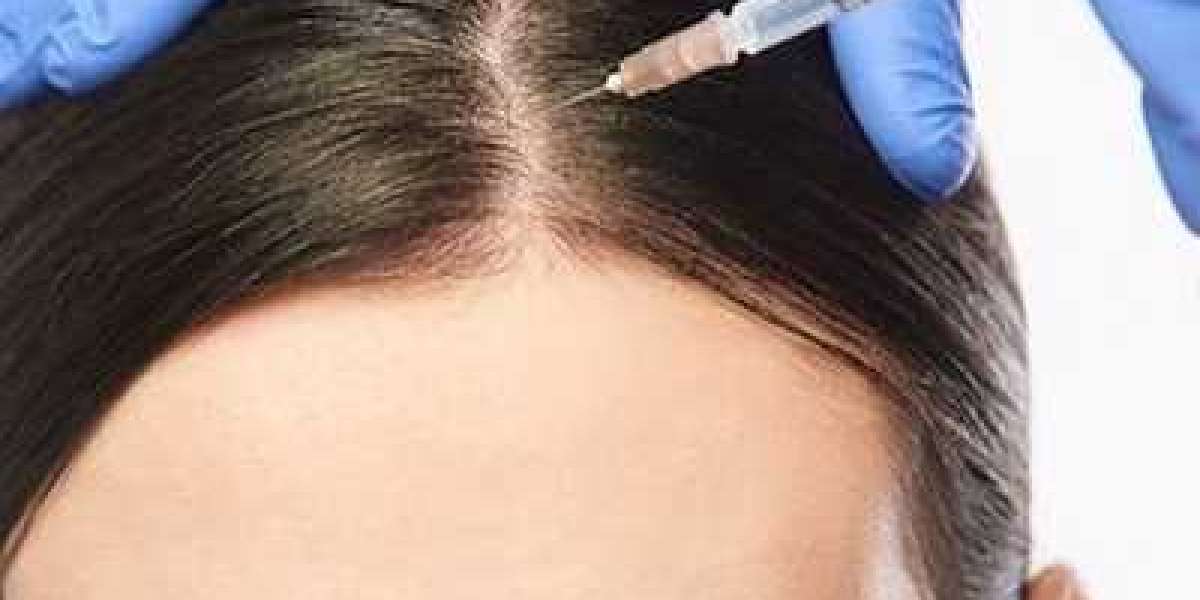 Can I Comb My Hair After PRP?