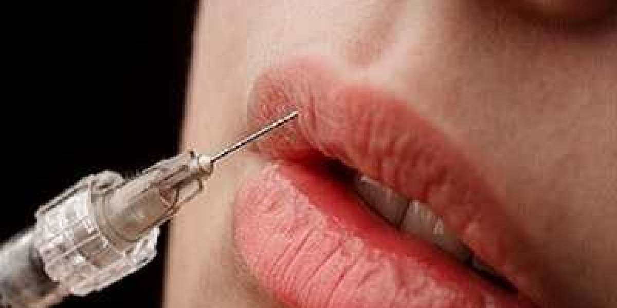 Top-Rated Lip Filler Services in Islamabad