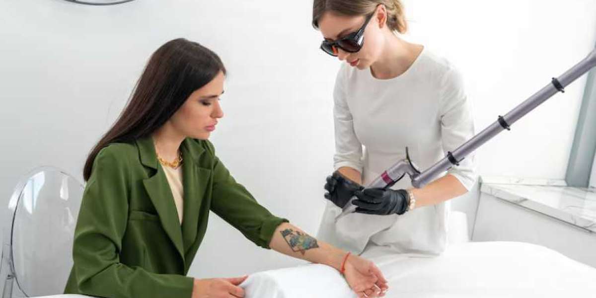 Regretting a tattoo? Here’s how you can choose a removal clinic