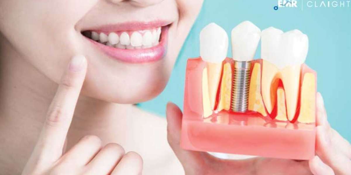 Global Aesthetic Implants Market Share, Size, Growth, Trends, Report, & Key Insights | 2024-2032