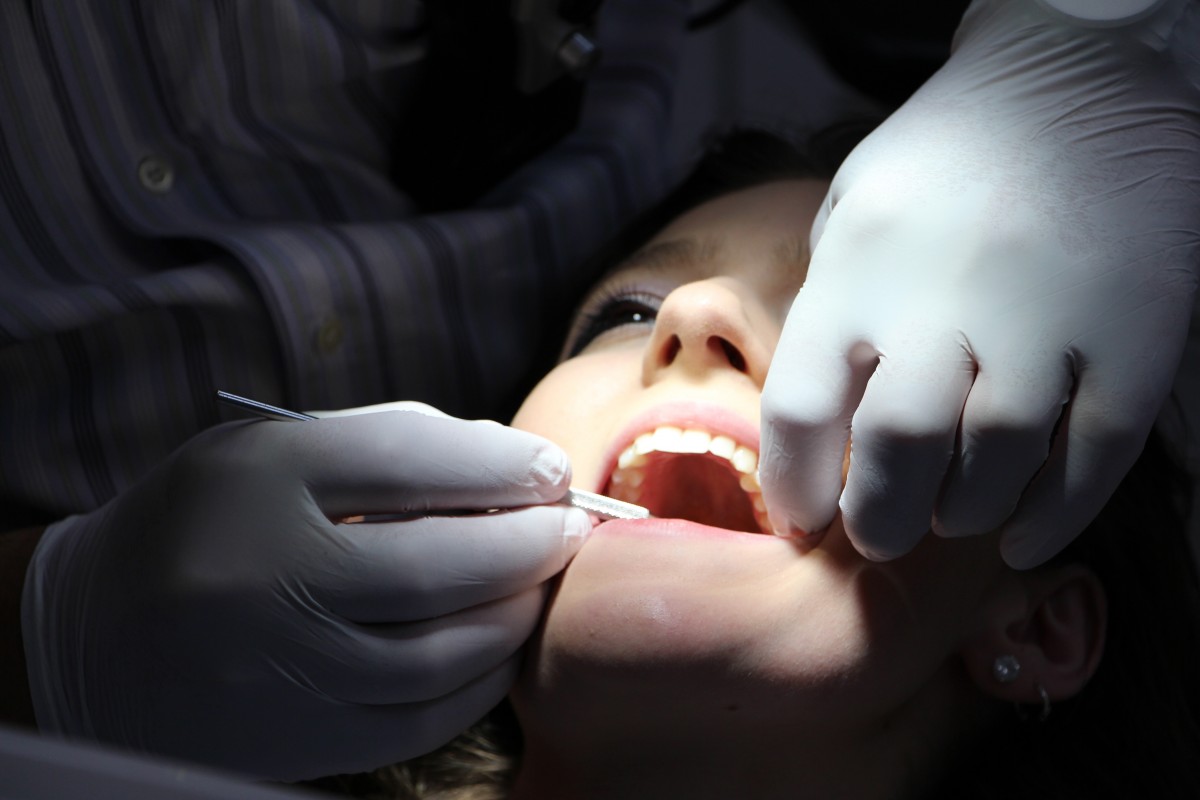 Top Tips for Finding a Qualified Wisdom Teeth Dentist in Your Area