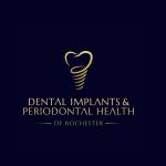 DENTAL IMPLANTS And PERIODONTAL HEALTH Profile Picture